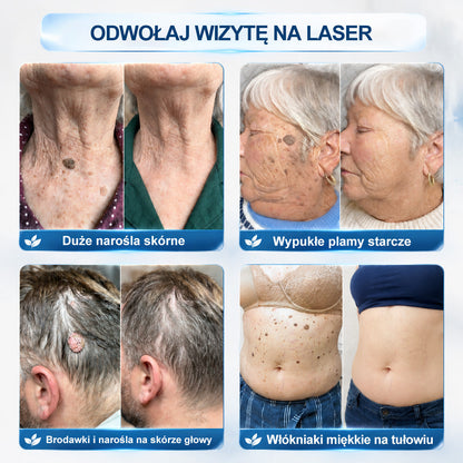 🍀👨‍⚕️👨‍⚕️Hiskin® 7 𝑫𝒏𝒊 𝑷𝒓𝒆𝒑𝒂𝒓𝒂𝒕 𝑫𝒐 𝑼𝒔𝒖𝒘𝒂𝒏𝒊𝒂 𝑾łó𝒌𝒏𝒊𝒂𝒌ó𝒘 𝑴𝒊ę𝒌𝒌𝒊𝒄𝒉 𝑰 𝑷𝒓𝒛𝒆𝒃𝒂𝒓𝒘𝒊𝒆ń(𝐁𝐞𝐳 𝐁ó𝐥𝐮, 𝐁𝐞𝐳 𝐁𝐥𝐢𝐳𝐧 – 𝐑𝐨𝐥𝐥-𝐨𝐧)