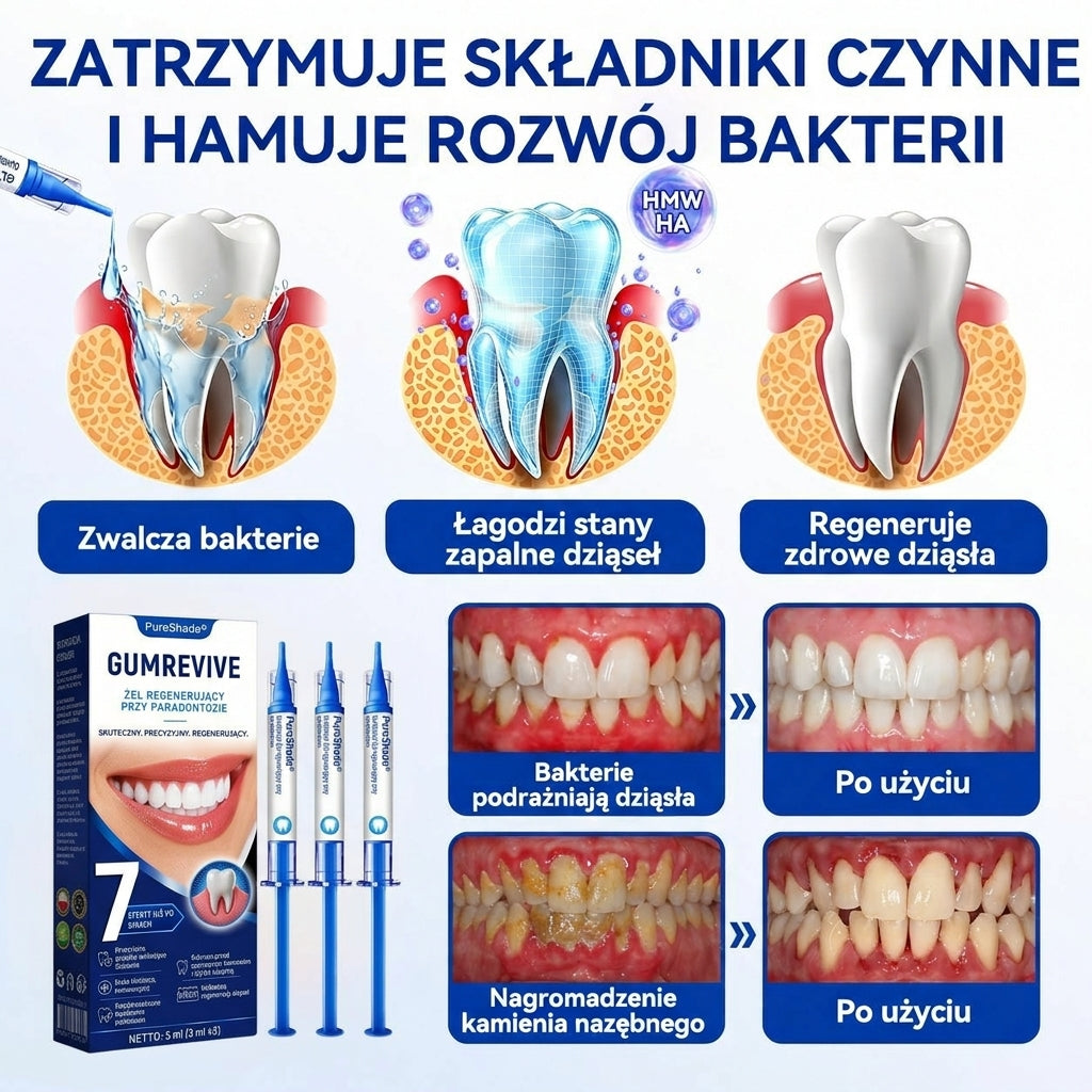 Przełomowe rozwiązanie do regeneracji jamy ustnej 🇵🇱🏅🦷 PureShade® GumRevive Żel do regeneracji przyzębia ⚡