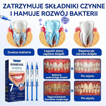 Przełomowe rozwiązanie do regeneracji jamy ustnej 🇵🇱🏅🦷 PureShade® GumRevive Żel do regeneracji przyzębia ⚡