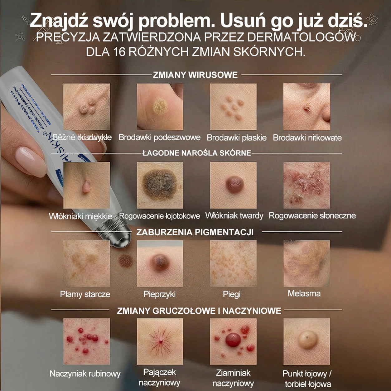 🍀👨‍⚕️👨‍⚕️Hiskin® 7 𝑫𝒏𝒊 𝑷𝒓𝒆𝒑𝒂𝒓𝒂𝒕 𝑫𝒐 𝑼𝒔𝒖𝒘𝒂𝒏𝒊𝒂 𝑾łó𝒌𝒏𝒊𝒂𝒌ó𝒘 𝑴𝒊ę𝒌𝒌𝒊𝒄𝒉 𝑰 𝑷𝒓𝒛𝒆𝒃𝒂𝒓𝒘𝒊𝒆ń(𝐁𝐞𝐳 𝐁ó𝐥𝐮, 𝐁𝐞𝐳 𝐁𝐥𝐢𝐳𝐧 – 𝐑𝐨𝐥𝐥-𝐨𝐧)